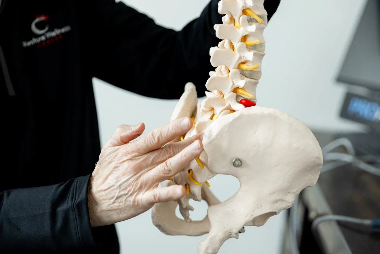 Is Spinal Decompression Covered by Insurance?